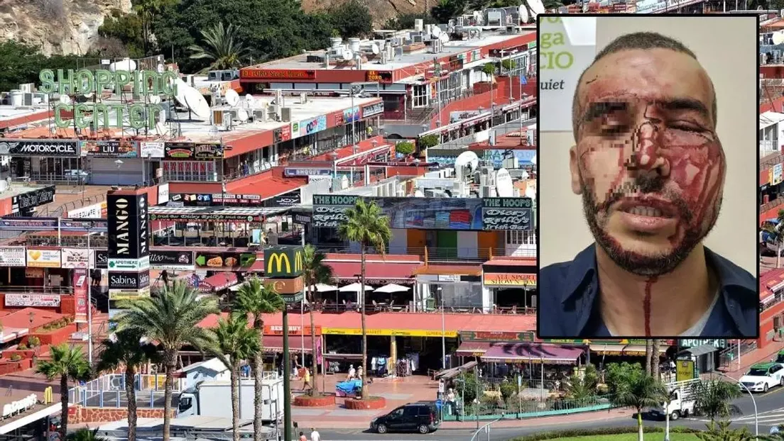 Siete marroquíes agreden brutalmente a un magrebí dueño de un restaurante en Gran Canaria para robarle la recaudación del día